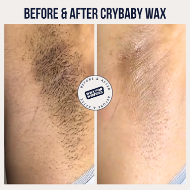 Before and after at-home underarm waxing with Crybaby vegan hard wax, smooth hair-free results