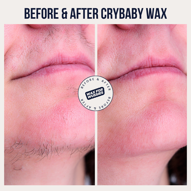 Before and after Crybaby Wax facial waxing on the upper lip and chin, coarse hair removed from the root for smooth, hair-free skin