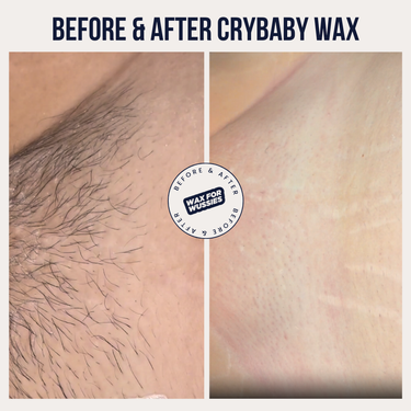 Before and after Crybaby Wax, coarse body hair removed for smooth, hair-free skin