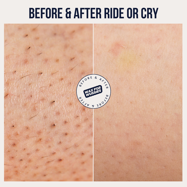Before and after Ride or Cry AHA exfoliating splash, rough bumpy skin to smoother texture with fewer ingrowns